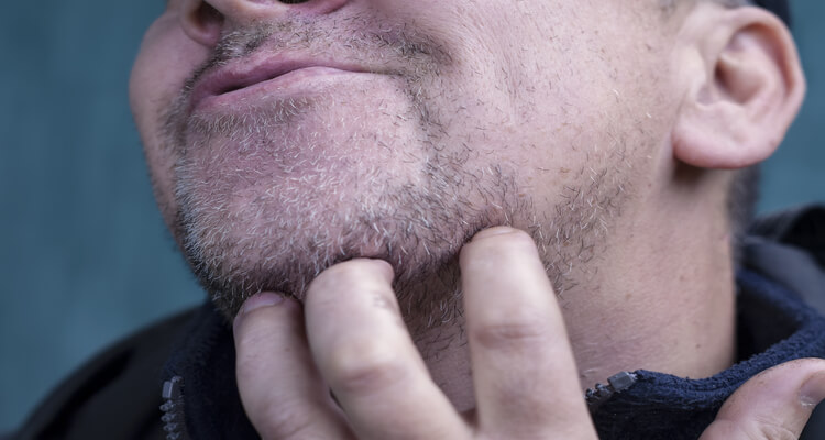Stress and Itching – Are They Interlinked?
