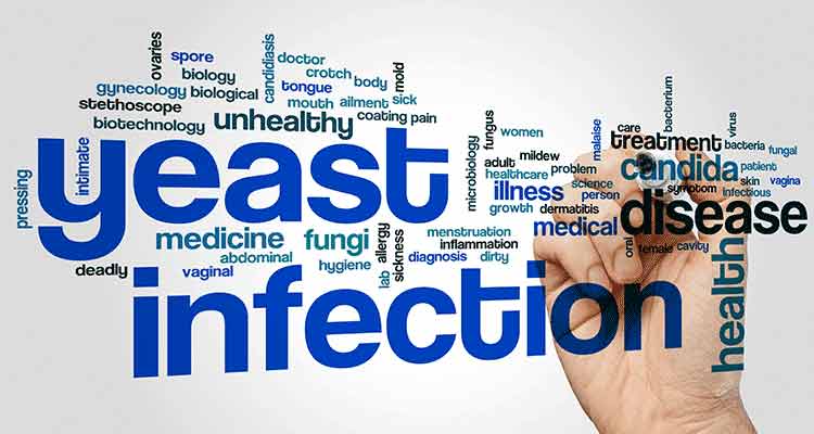 Yeast Infection