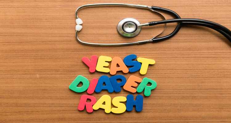 5 Skill How To Treat Yeast Infections In Babies Latest