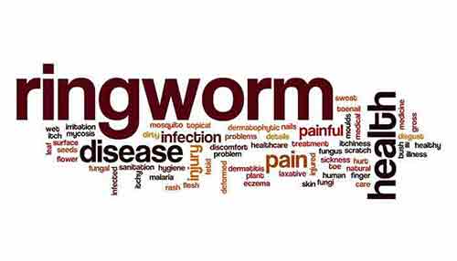 Treatment for Ringworm