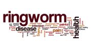 Most Frequently Asked Questions about Ringworm