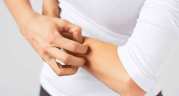 Are Antifungal Creams an Effective Remedy for Itchy Skin?