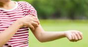 How to Save Yourself from Itching this Summer?