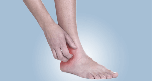 How long does it take to Recover from Jock Itch after Starting Treatment?